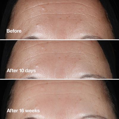 CLINIQUE Smart Clinical Repair Wrinkle Correcting Serum Stangrinamasis veido serumas