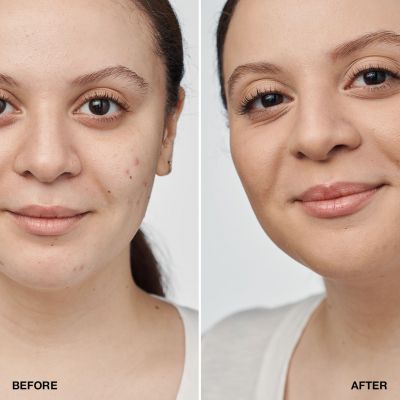 CLINIQUE Even Better Clinical™ Serum Foundation SPF 20 Kreminė pudra